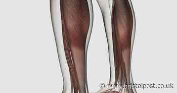 Little known leg condition which could increase your risk of a heart attack