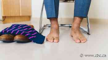 Hamilton saw 93 diabetes-related foot amputations in 1 year. New campaign seeks to reduce numbers