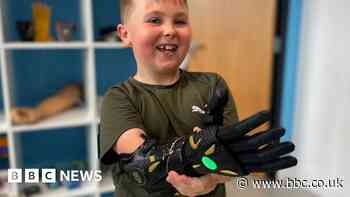 Moment boy gets Black Panther themed bionic hand in Bristol