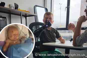 Oswaldtwistle boy receives bionic limb thanks to fundraiser