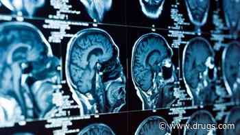 In Mice, a Preventive Vaccine Clears Brain Plaques Tied to Alzheimer's