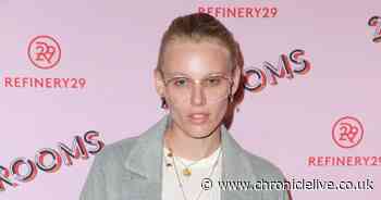 Model almost died and lost her legs due to Toxic Shock Syndrome caused by tampon