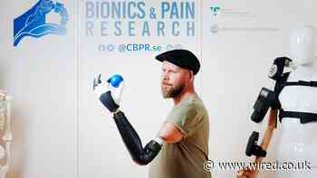 This Prosthetic Limb Actually Attaches to the Wearer’s Nerves