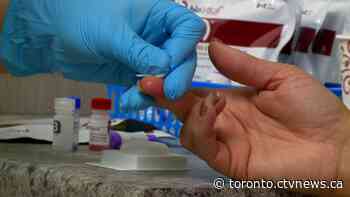Clients of private health clinic in Richmond Hill should be tested for HIV, hepatitis: York Region