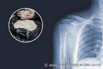 Royal Mint create new silver jewellery made from X-ray films