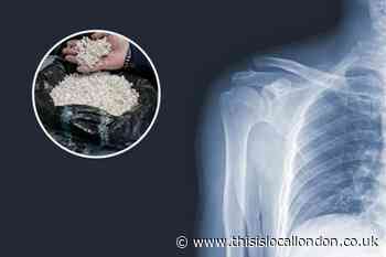 Royal Mint create new silver jewellery made from X-ray films