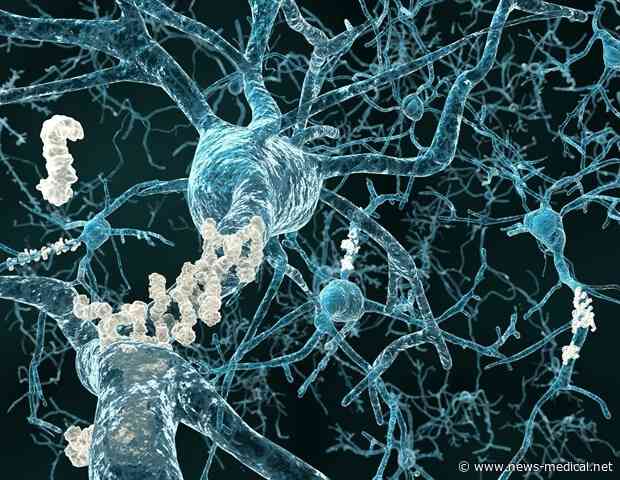 $11 million NIH grant focuses on cognitive function in Down syndrome-associated Alzheimer’s