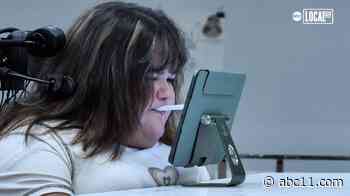 Student born with rare disease pursues passion for art