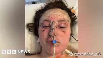 Merthyr explosion: Teen saw boyfriend go up in flames