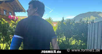 Frau Susie teilt Foto mit Gipsarm: Toto Wolff beim Radfahren verletzt