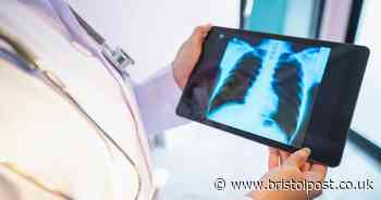 Lung cancer's simple finger test you can do at home that could spot early warning signs