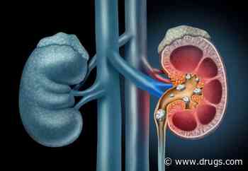 Added Sugar Consumption Increases Risk for Kidney Stones