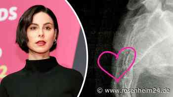 Doppelter Kreuzbeinbruch: Lena Meyer-Landrut hatte schweren Reitunfall