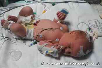 Preston hospital midwives blamed for boy’s brain injury