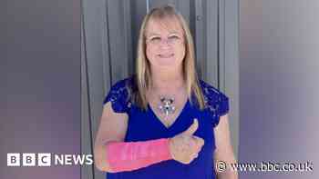 Texas woman injured after hawk drops snake on her