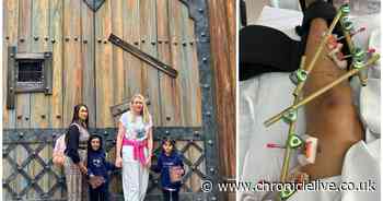 Teacher speaks of 'horrific' accident at Alnwick Garden's Lilidorei in Northumberland which led to emergency leg op