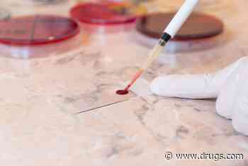 Misdiagnosis Common for Suspected Myelodysplastic Neoplasms