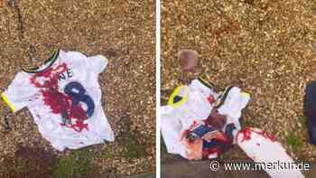 „Er ist für mich gestorben“: Tottenham-Fan vernichtet sein Kane-Trikot und argumentiert mit Zweitem Weltkrieg