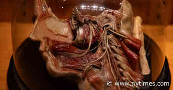 Mütter Museum in Philadelphia Weighs Dialing Down its ‘Electric Frankness’