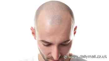 Map reveals the 20 countries where men around the world are most likely to be bald - and US and UK's rank might shock you