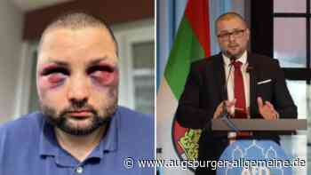 Polizei ermittelt nach Angriff auf Augsburger AfD-Politiker Jurca