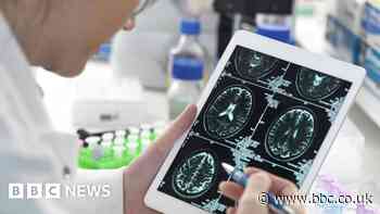 Edinburgh firm developing early Alzheimer's test