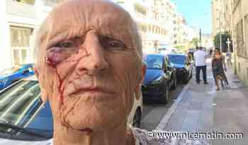 Le médecin violemment agressé à Nice vient de déposer plainte pour des insultes en ligne