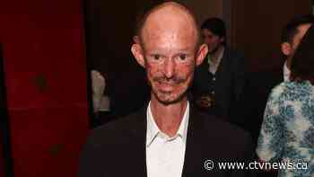 Darren Kent, actor in 'Game of Thrones,' dead