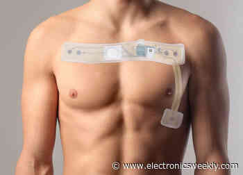 Stretchy PCBs in smart cardiac monitor, and more