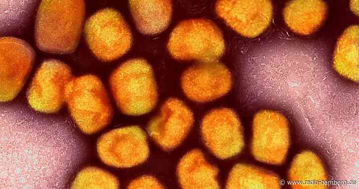 Das Virus ist noch da: Nach langer Ruhe wieder Mpox