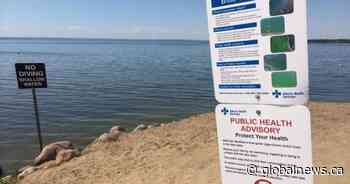 Blue-green algae advisory issued for Pigeon and Wizard lakes