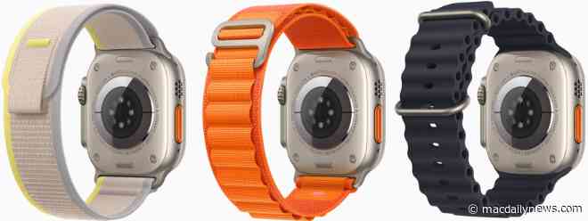 Your Apple Watch band could carry shocking levels of bacteria