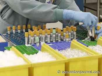 Alberta NDP calls for auditor general to investigate failed Dynalife lab deal