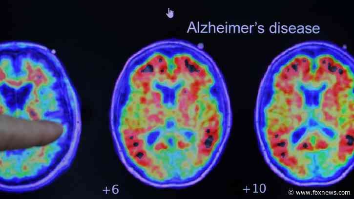 Japanese health ministry panel recommends approval of Alzheimer's treatment Leqembi