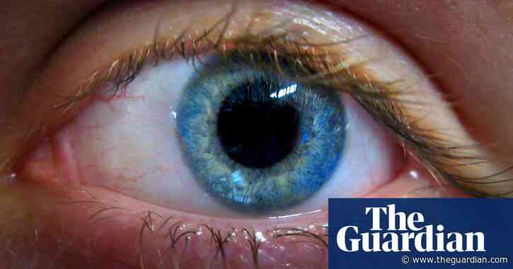 3D eye scans at opticians could identify those at risk of Parkinson’s, study finds