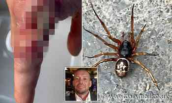 'Britain's most dangerous spider' strikes in Kent: Man's finger begins ROTTING away after he's bitten by a noble false widow