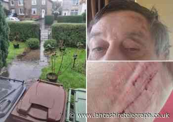 Disabled man injured by sandbag slams council over flooding