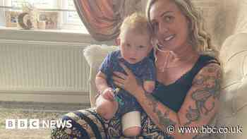 Mum fundraising for son who lost limbs to sepsis