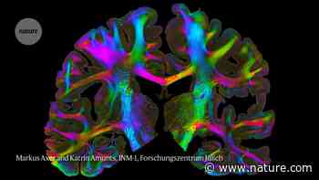 500 Scientists Spent €600 million Over 10 Years On The Human Brain Project. How’d It Go?