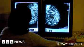 University of Sheffield researching new drugs for breast cancer