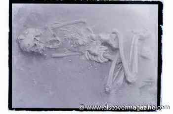 Why Did An Ancient Japanese Society Practice Skull Modification?