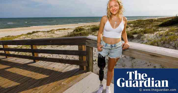 At 17, a shark attack cost me my leg. A year later, I’m back in the water where I almost died