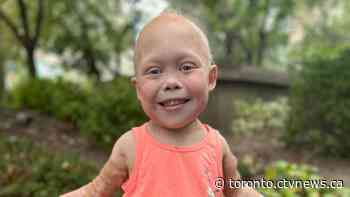 9-year-old miracle child undergoes transplant for rare disease