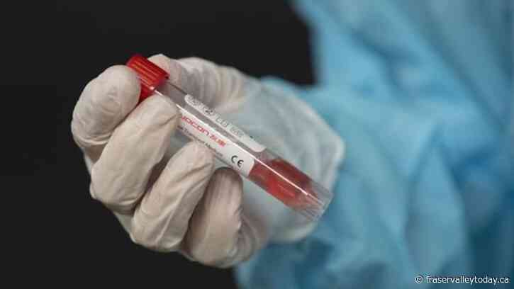 Canada’s first case of new COVID variant is detected in B.C.