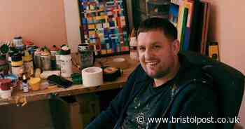 'I fell asleep in the back of a taxi and woke up with both legs shattered'