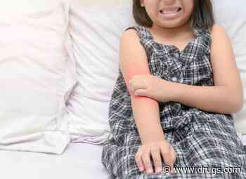 Atopic Dermatitis Increases Risk for Inflammatory Bowel Disease