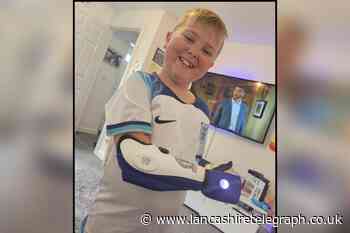 Oswaldtwistle boy receives Blackburn Rovers bionic limb sleeve