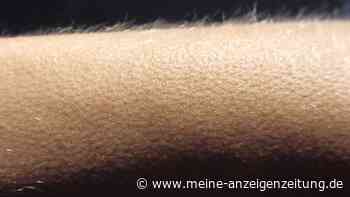 Warum bekommen wir Gänsehaut? Ein Blick auf die faszinierende Reaktion unseres Körpers