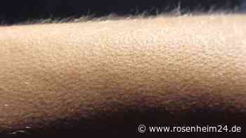 Warum bekommen wir Gänsehaut? Ein Blick auf die faszinierende Reaktion unseres Körpers