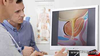 An Expert Answers Your Questions About Prostate Cancer